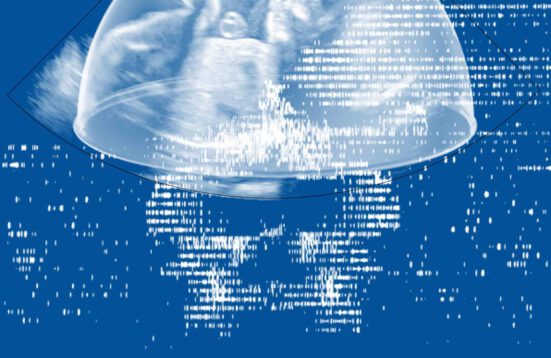 digital rendering from an ultrasound scan of a fetus. the words UNBORN 0X9