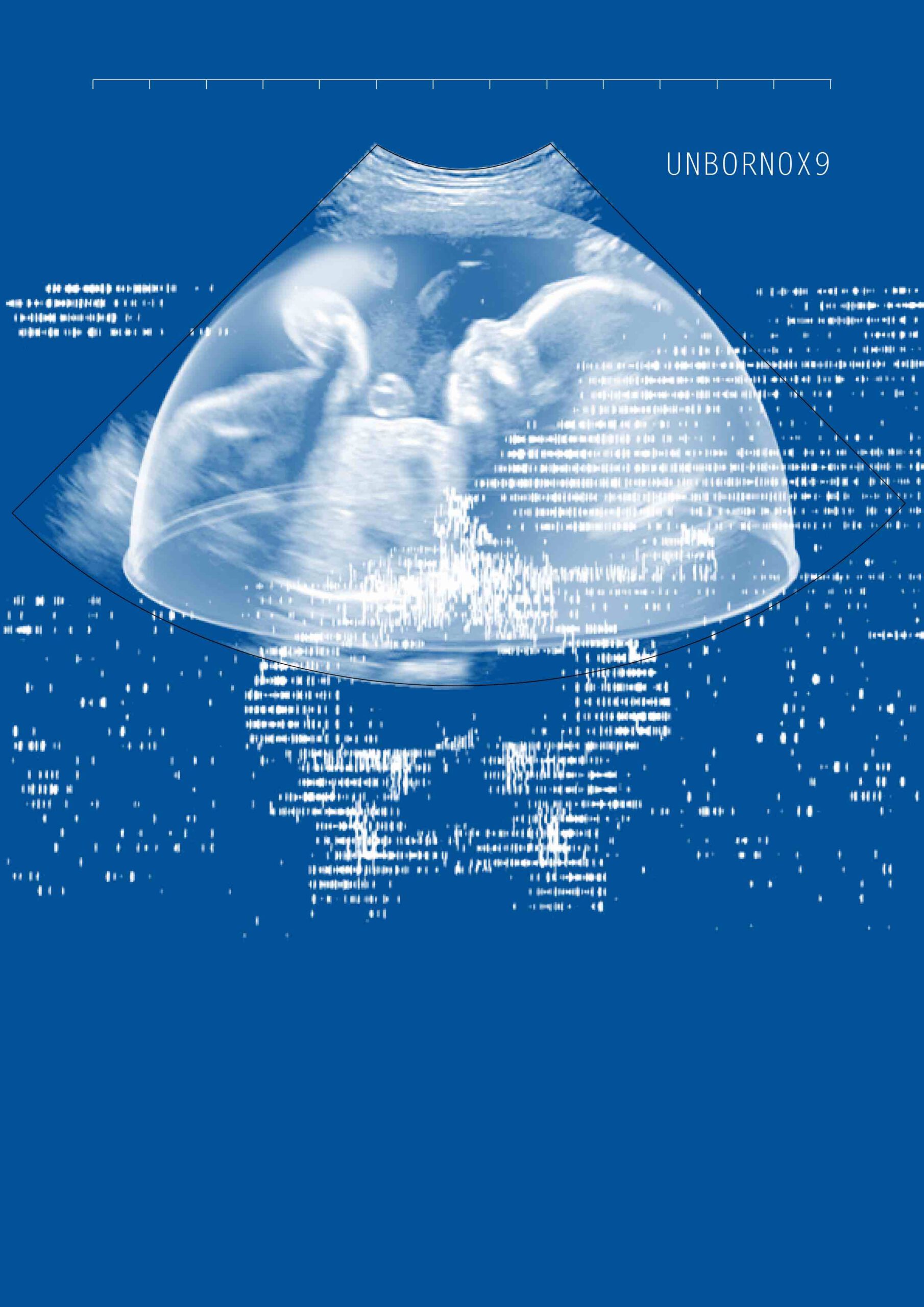 digital rendering from an ultrasound scan of a fetus. the words UNBORN 0X9