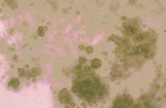 green circles on a beige and pink background