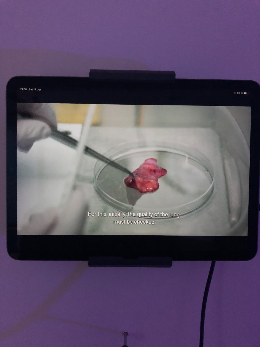 a small video screen showing a gloved hand forceps and some red flesh in a Petri dish and the subtitle:" For this, initially, the quality of the lung must be checked."