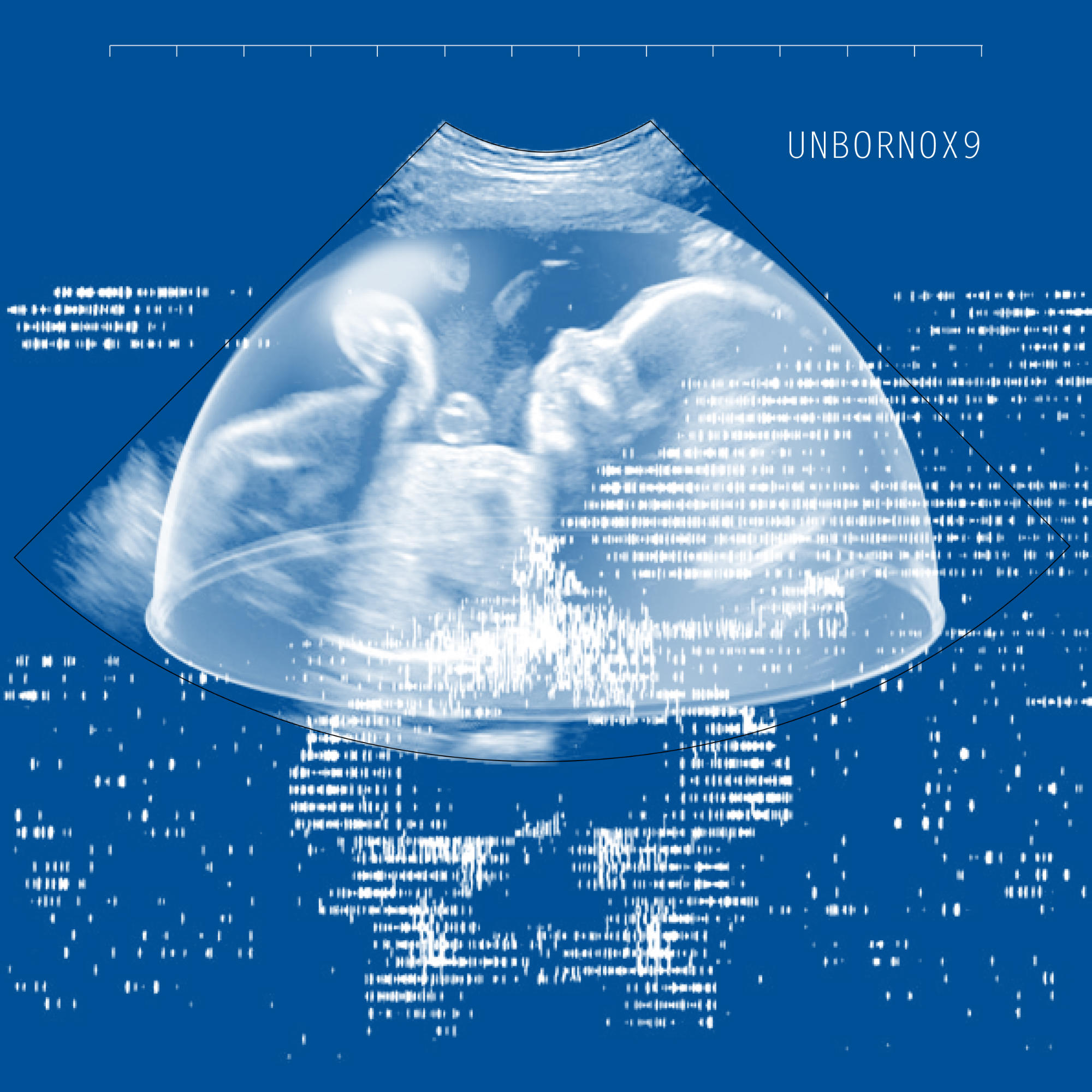 digital rendering from an ultrasound scan of a fetus. the words UNBORN 0X9