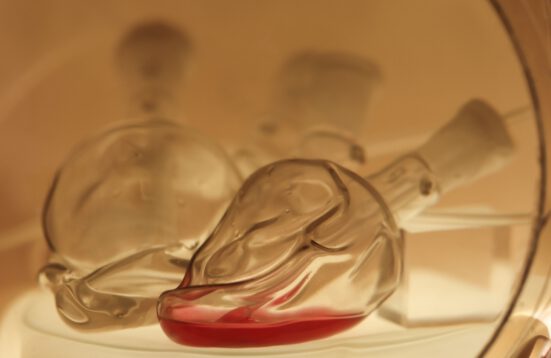 a glass vessel with red liquid