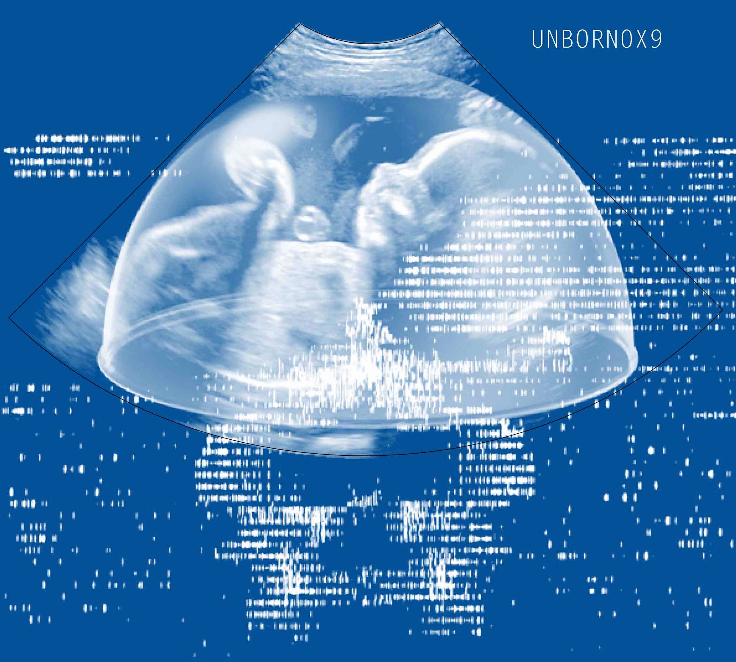 digital rendering from an ultrasound scan of a fetus. the words UNBORN 0X9